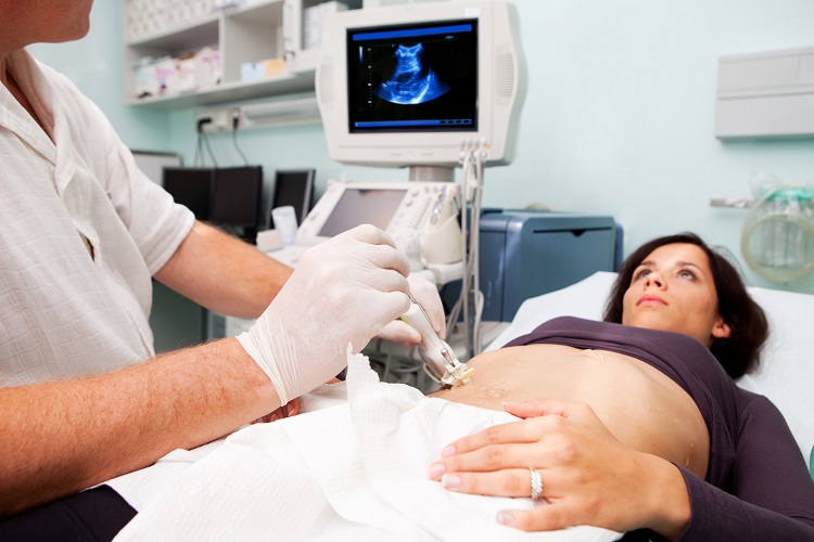 Biopsja kosmówki, jako typ inwazyjnego badania prenatalnego
